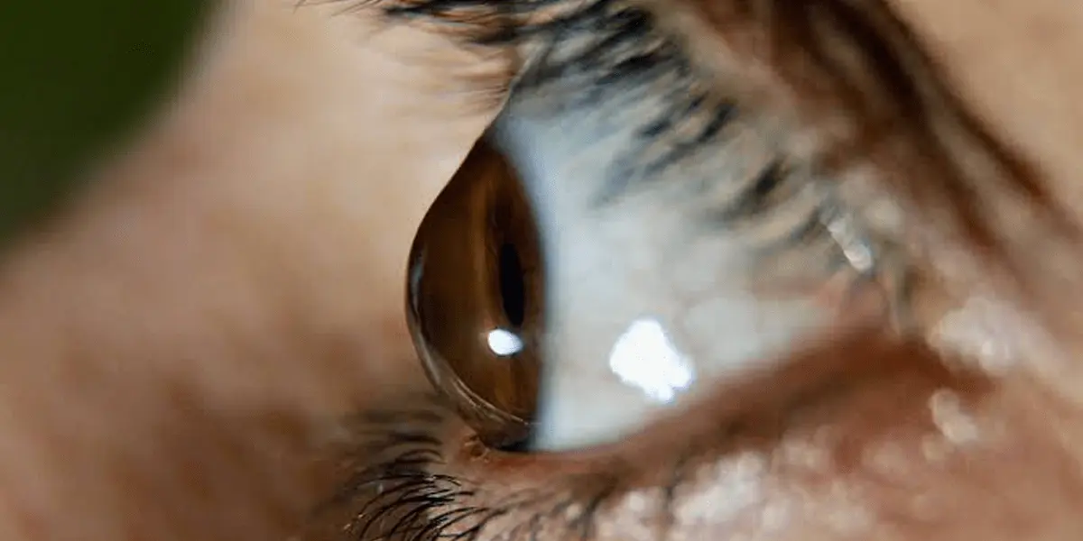 Cornea care banner